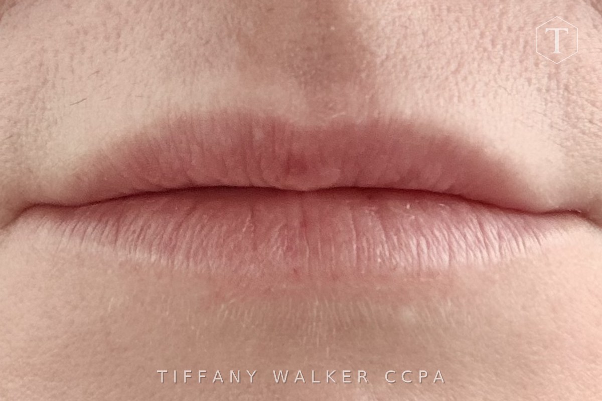 Lips after dissolving